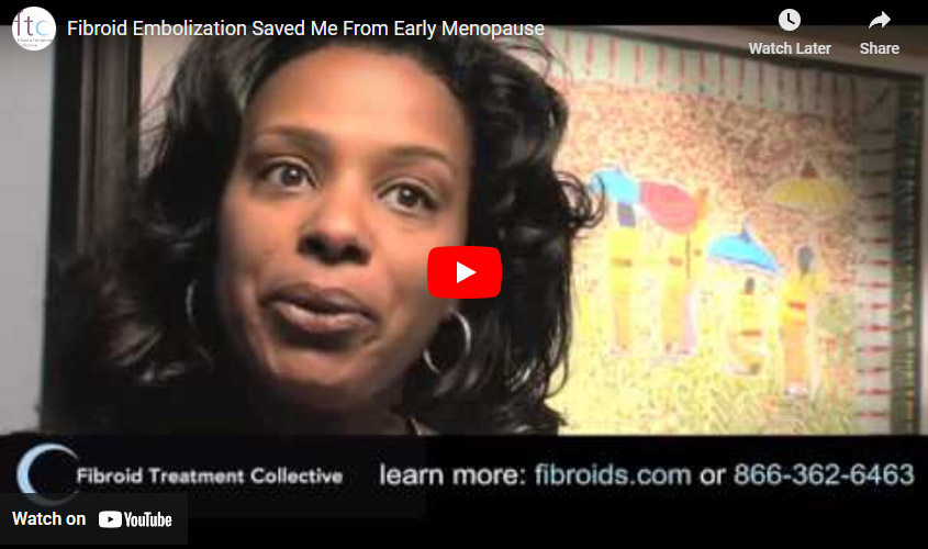Michelle-youtube-image Fibroid Embolization Saved Me From Early Menopause